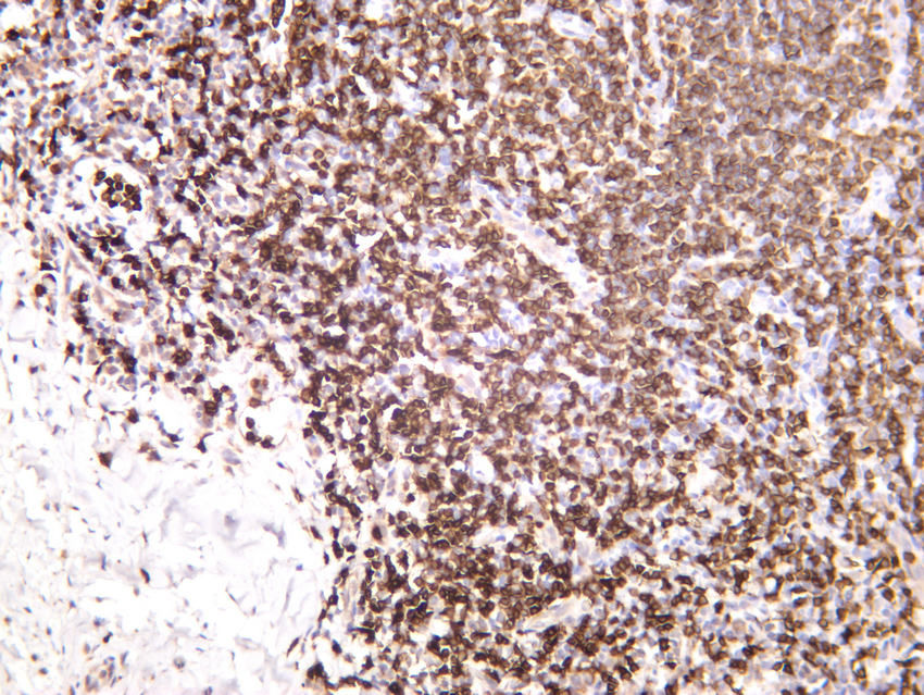 IHC