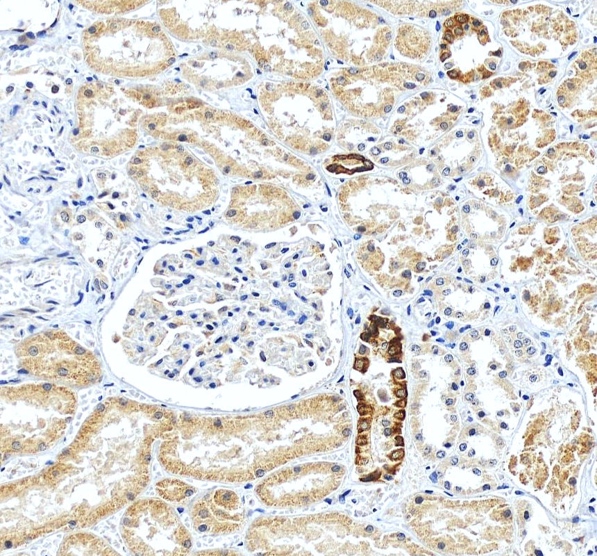 IHC