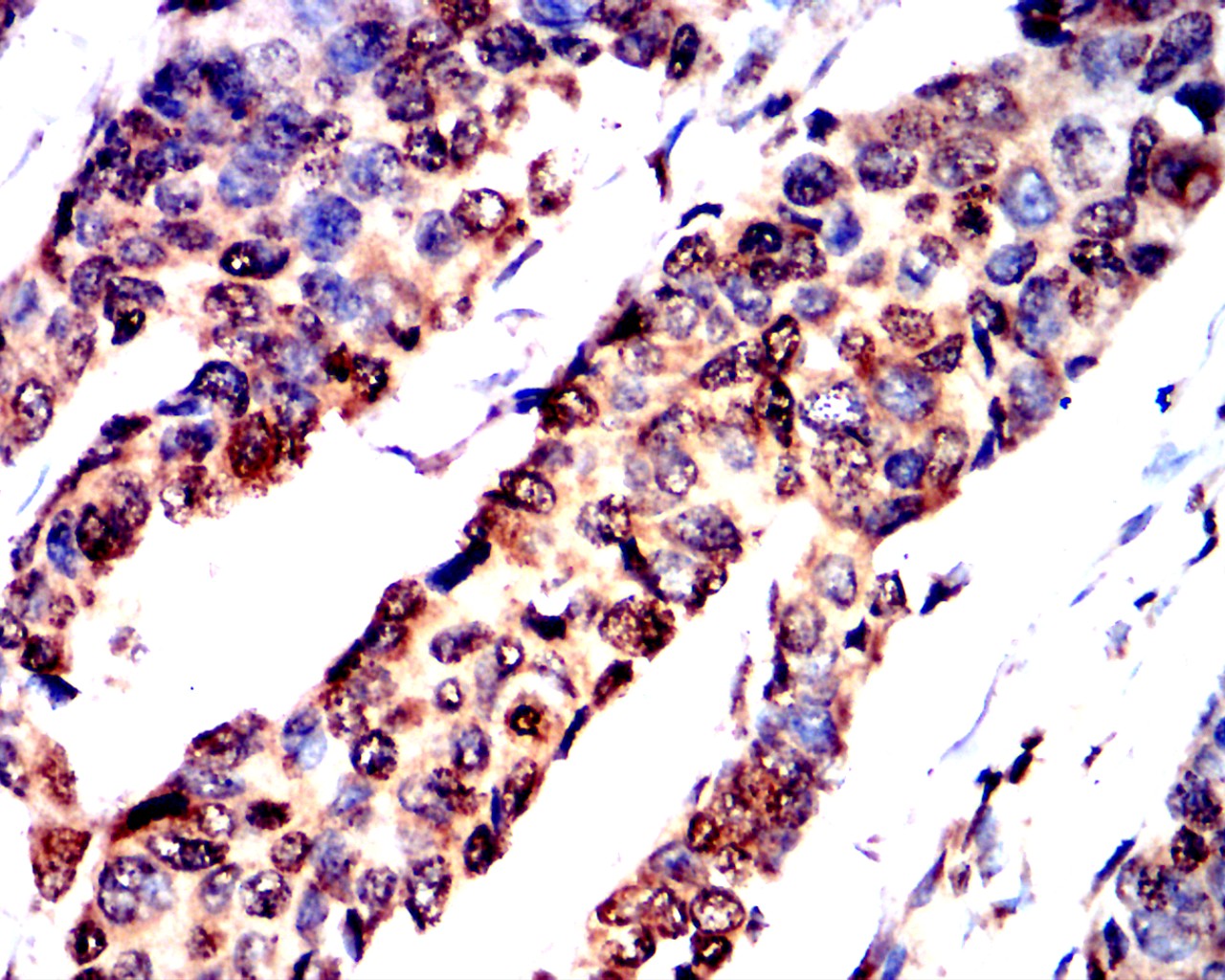IHC