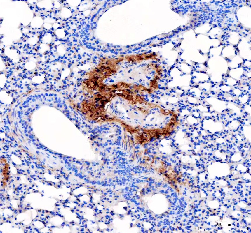 IHC