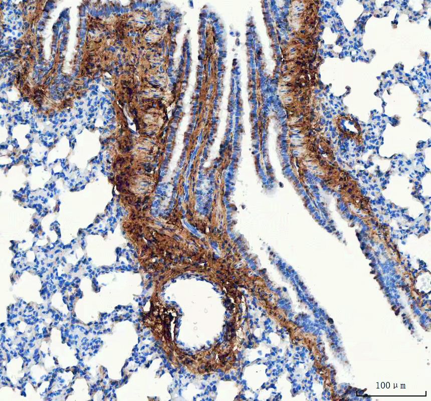 IHC