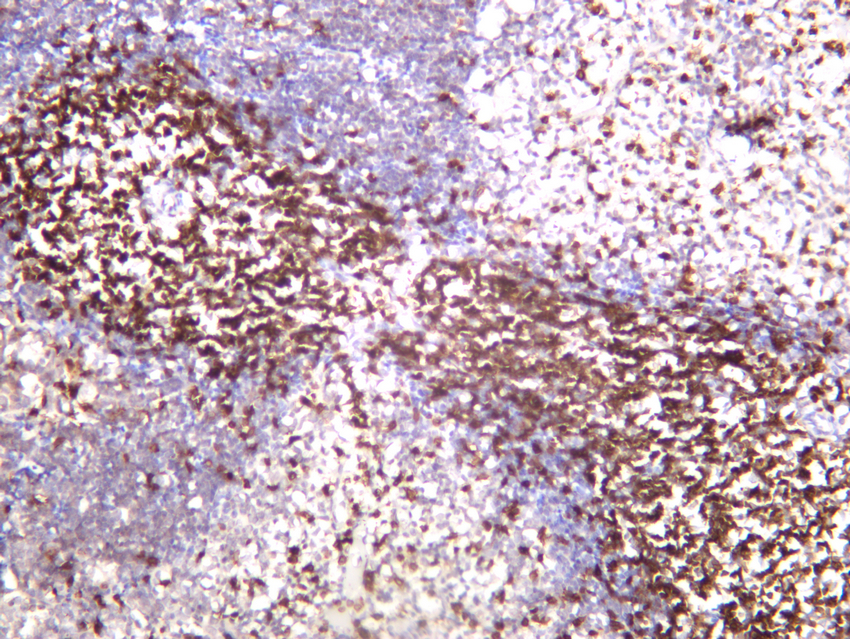 IHC