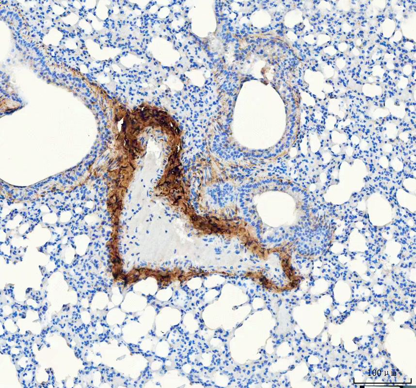 IHC