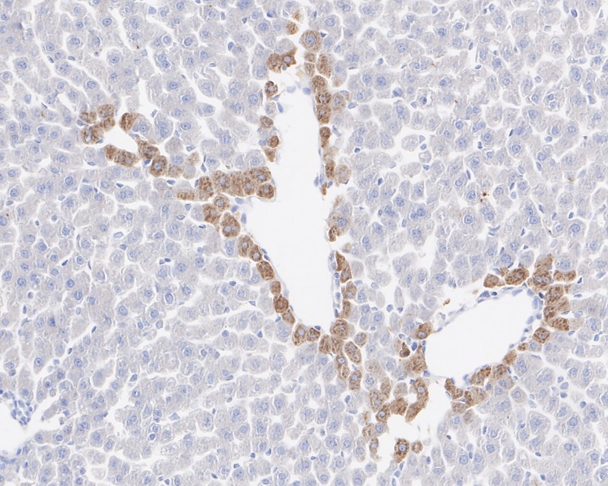 IHC