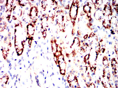 IHC