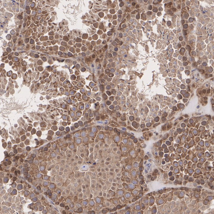 IHC