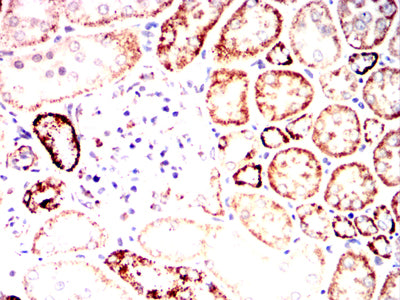 IHC