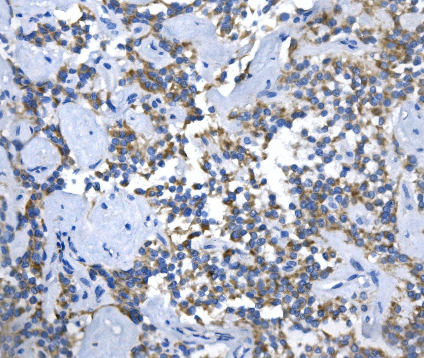 IHC