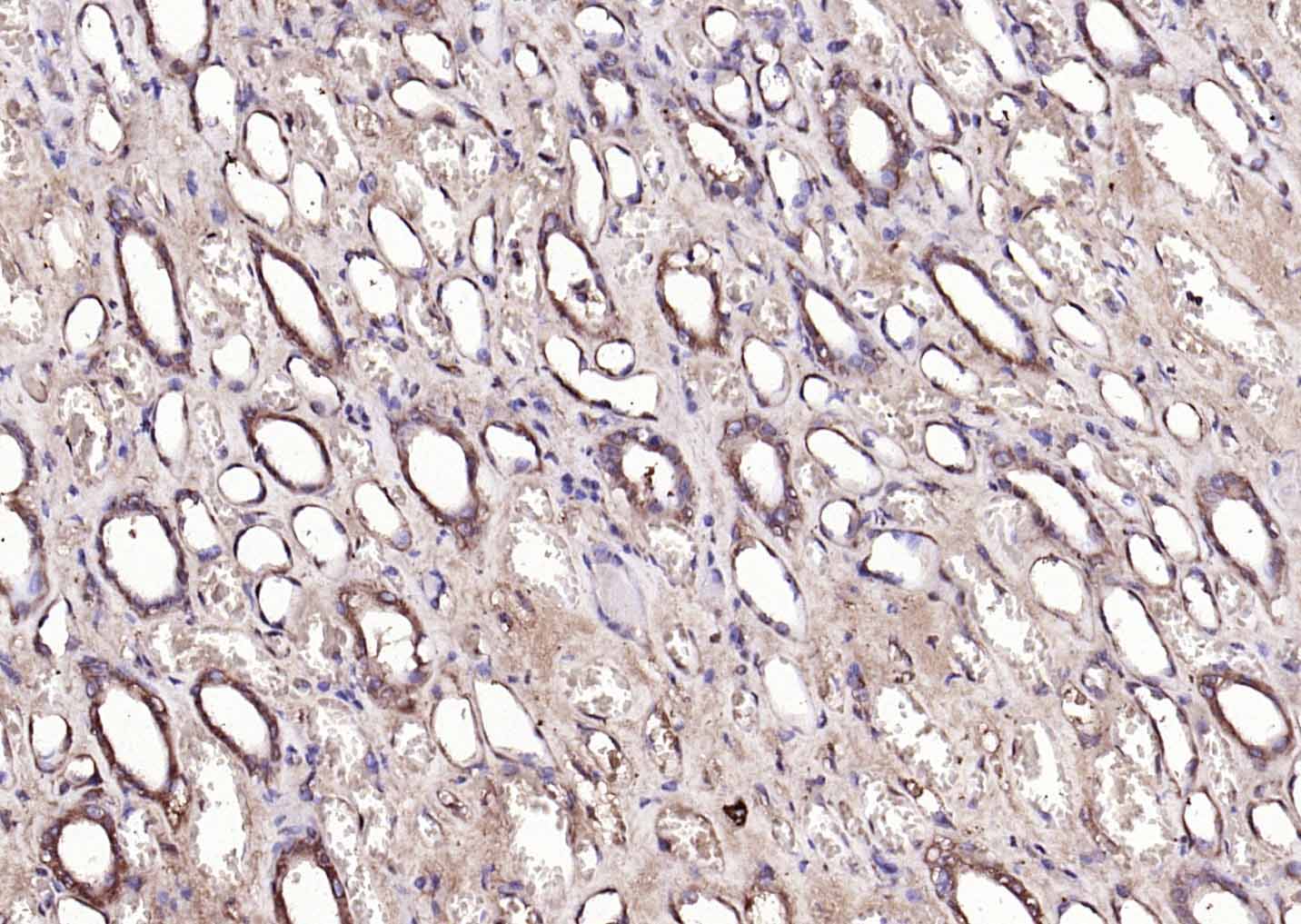 IHC