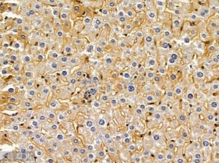 IHC
