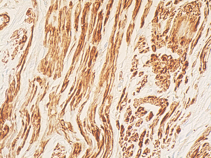 IHC