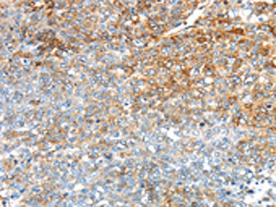 IHC