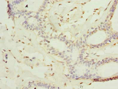 IHC
