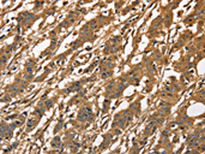 IHC
