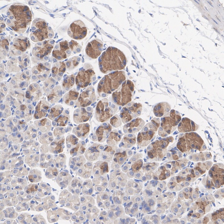 IHC