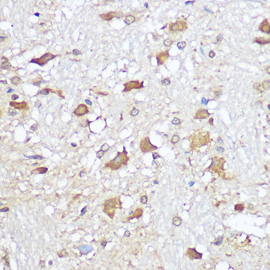 IHC