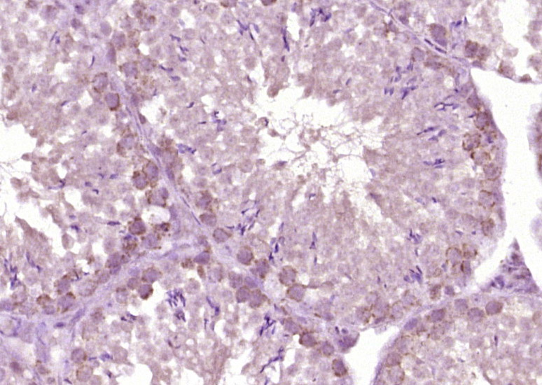 IHC