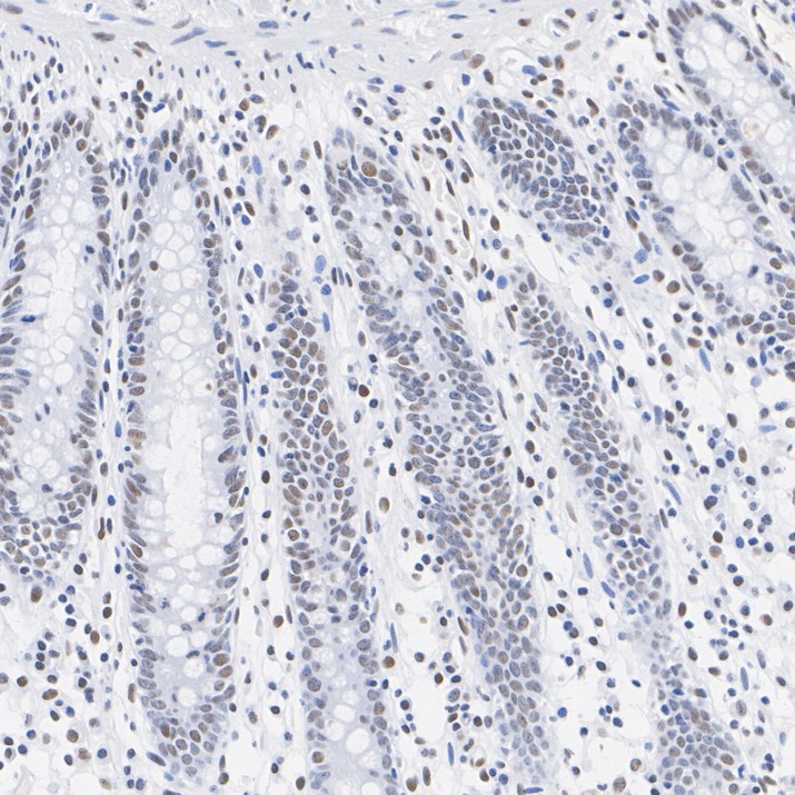 IHC