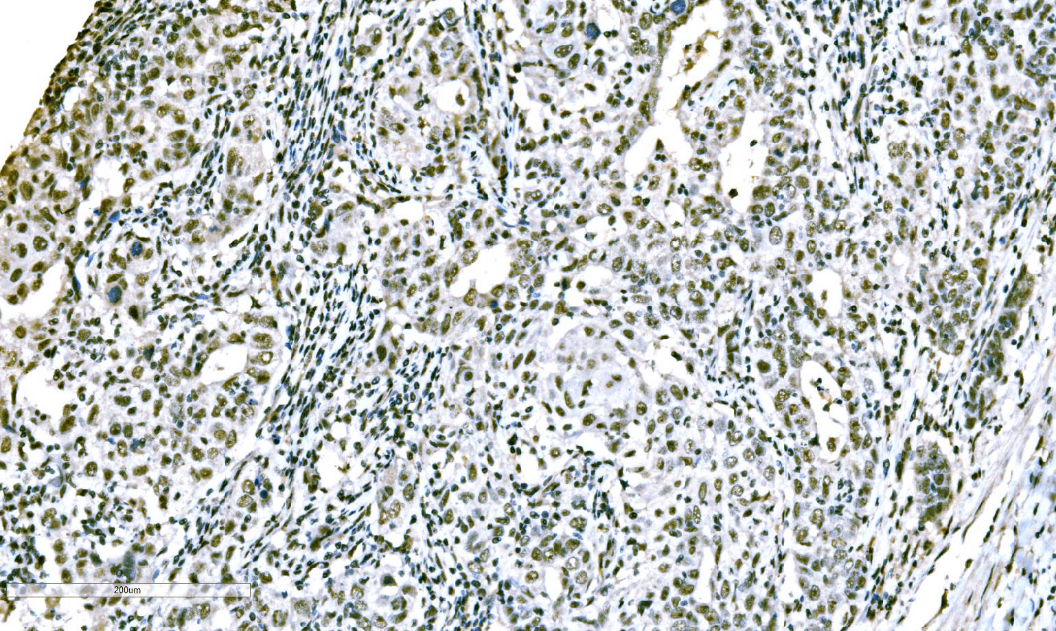 IHC