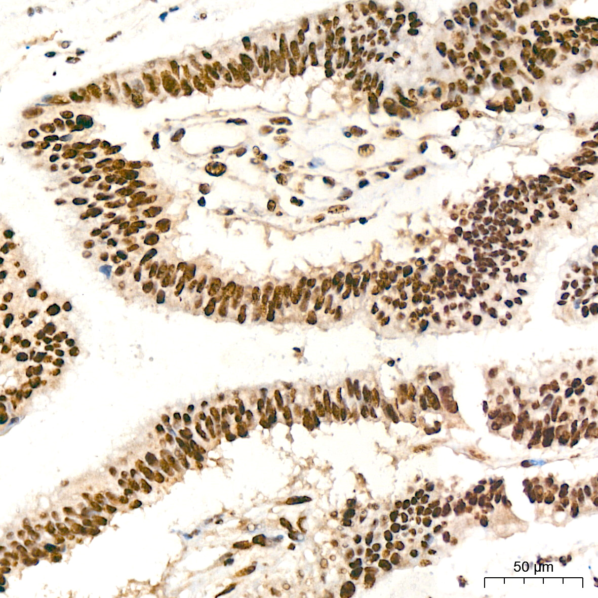 IHC