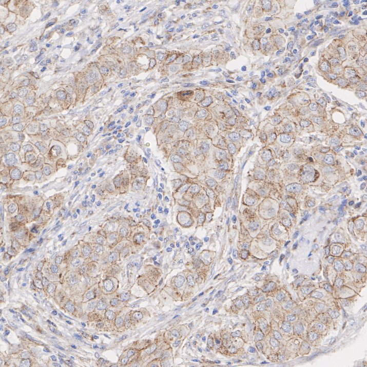 IHC