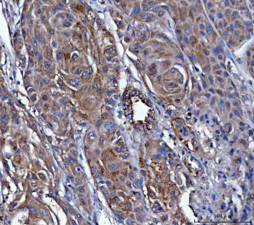 IHC