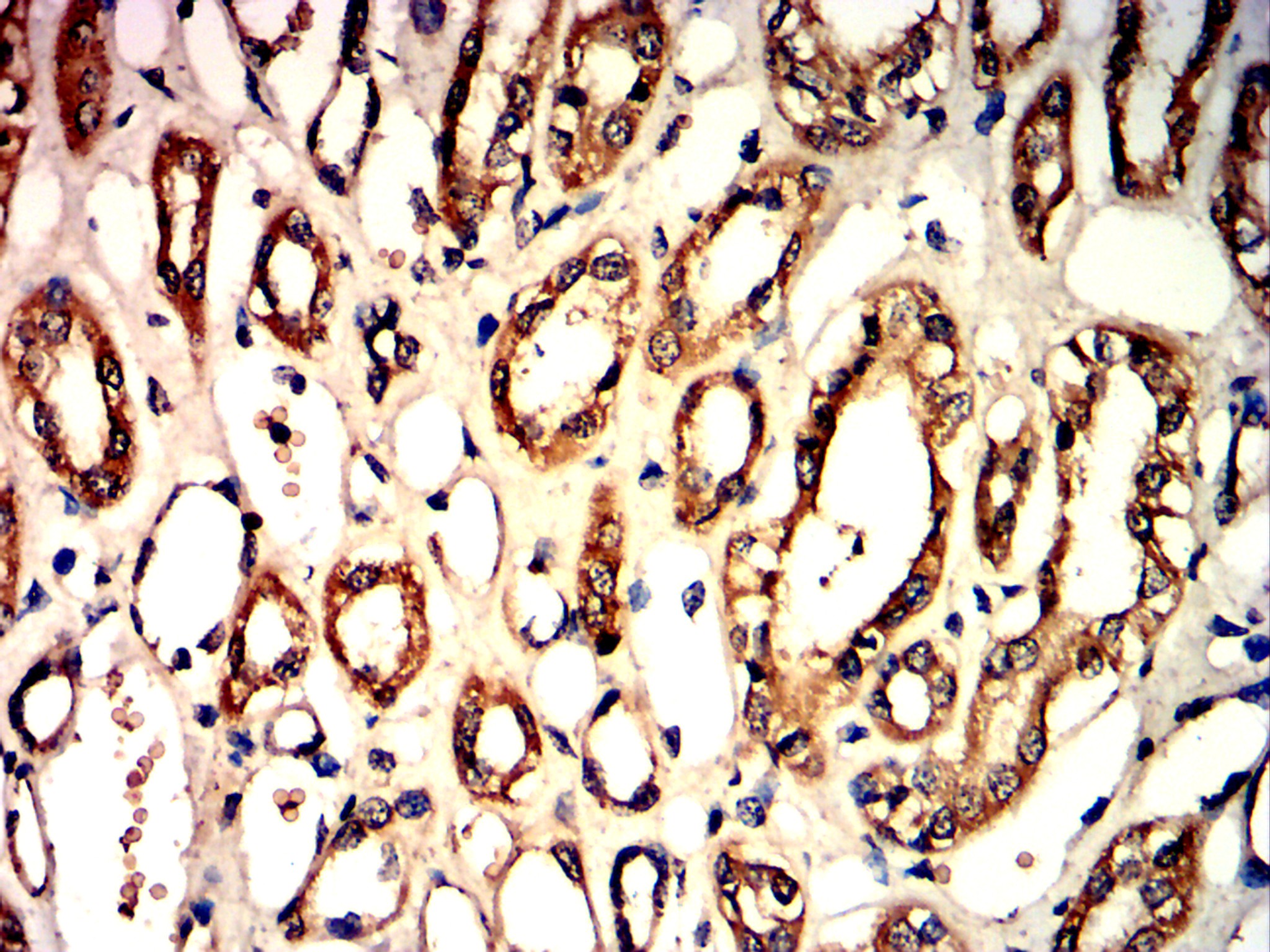 IHC