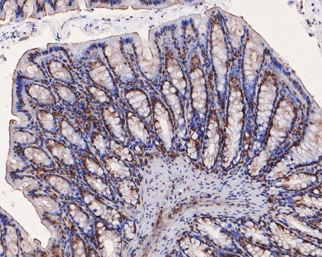 IHC