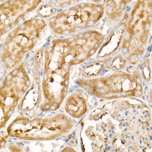 IHC