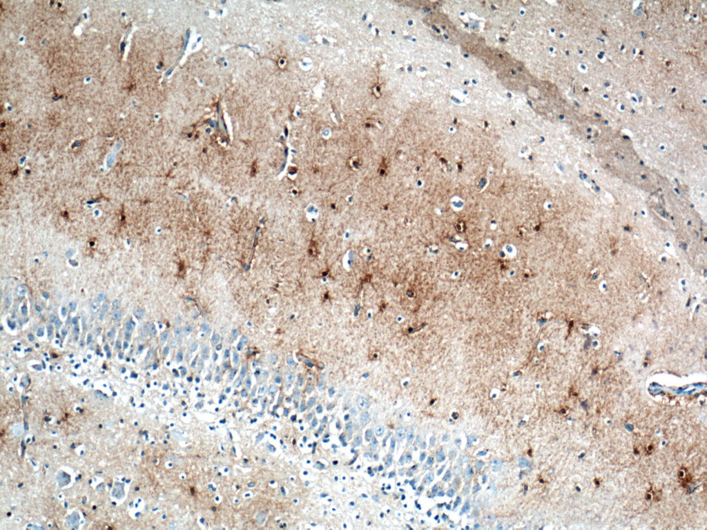 IHC