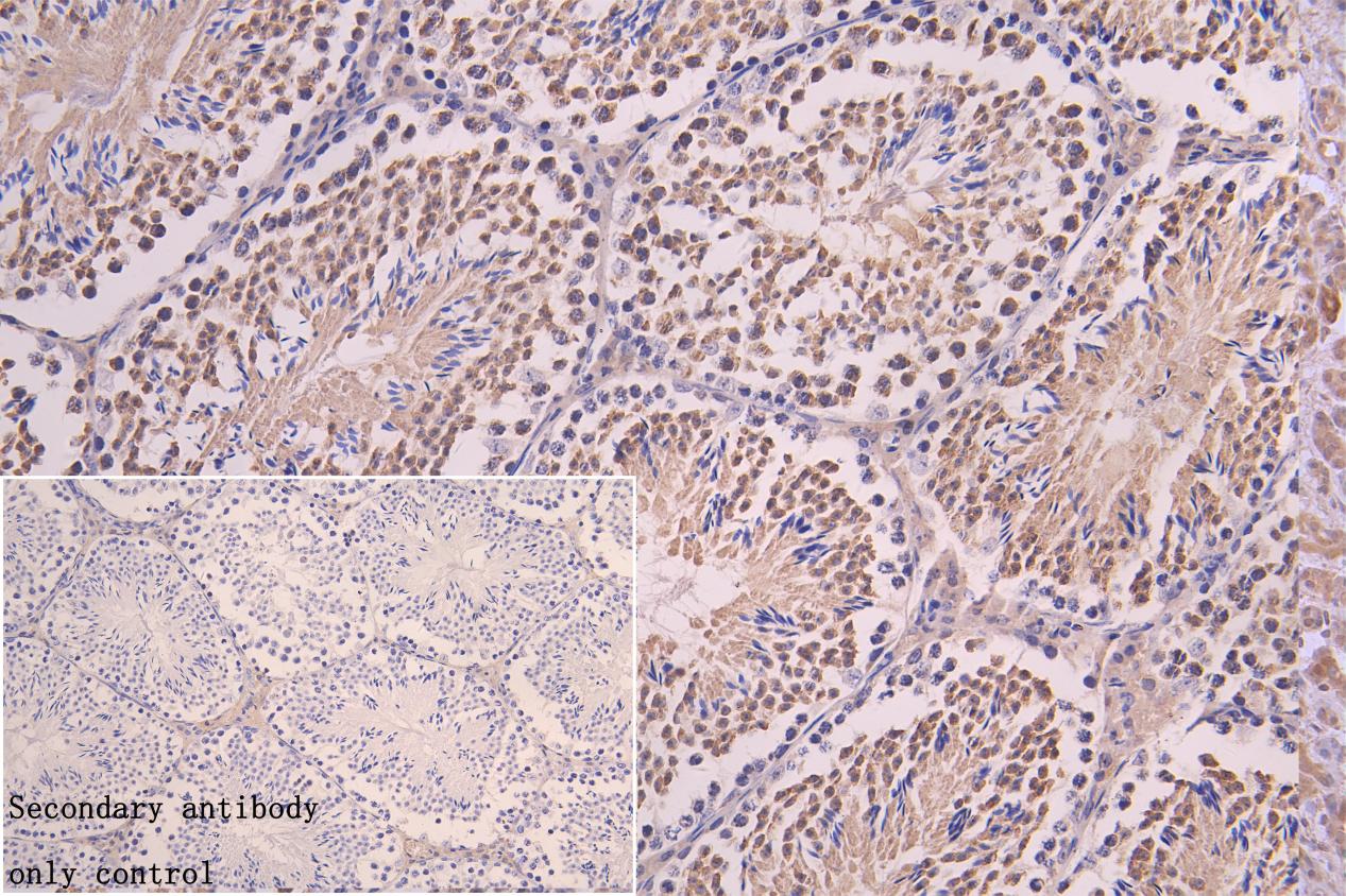 IHC