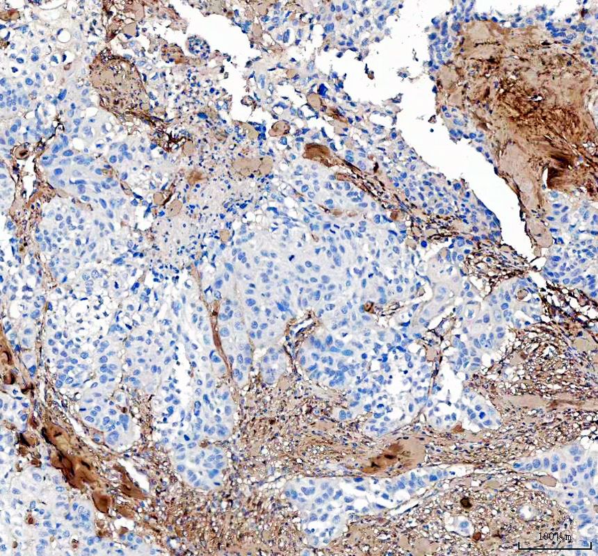 IHC