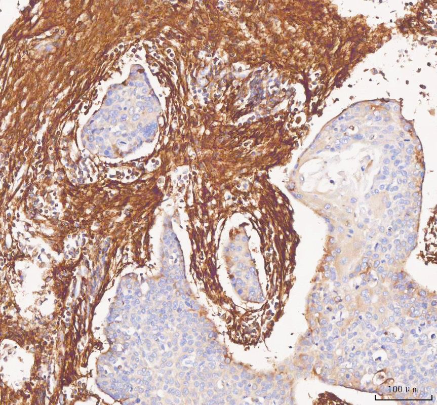 IHC