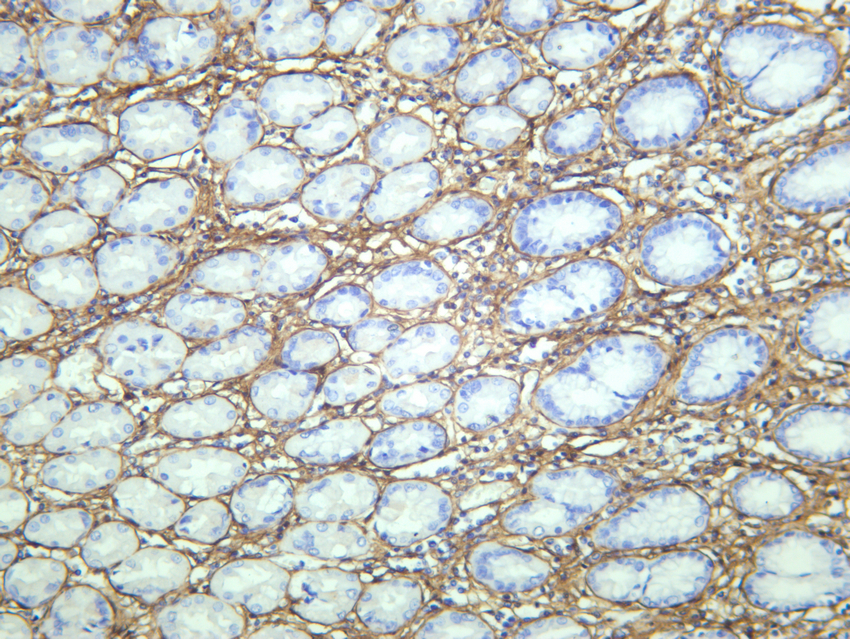 IHC