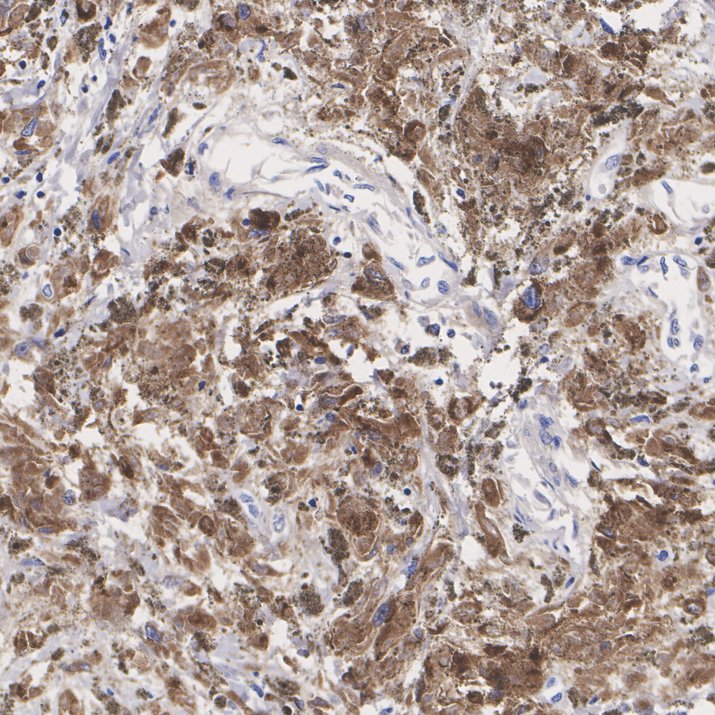 IHC