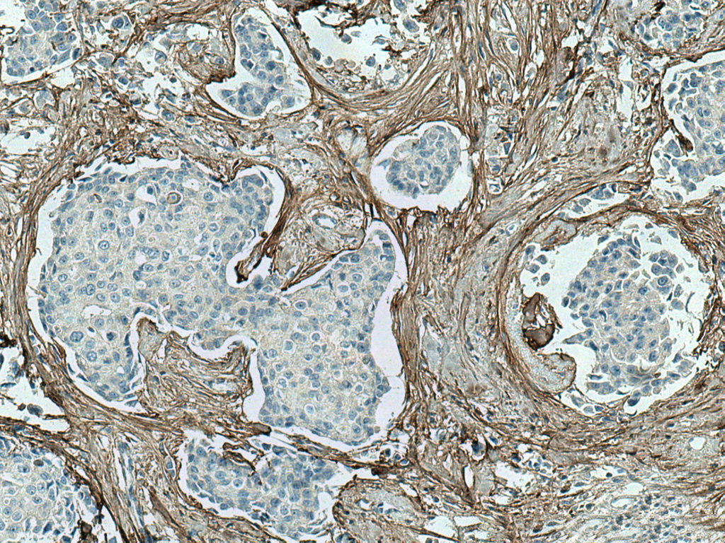 IHC