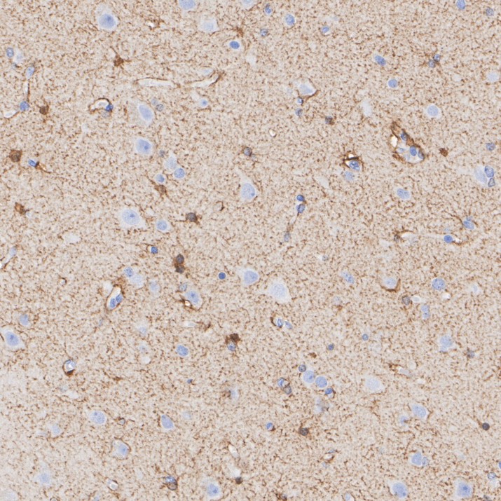 IHC
