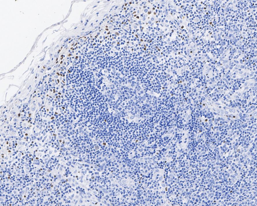 IHC