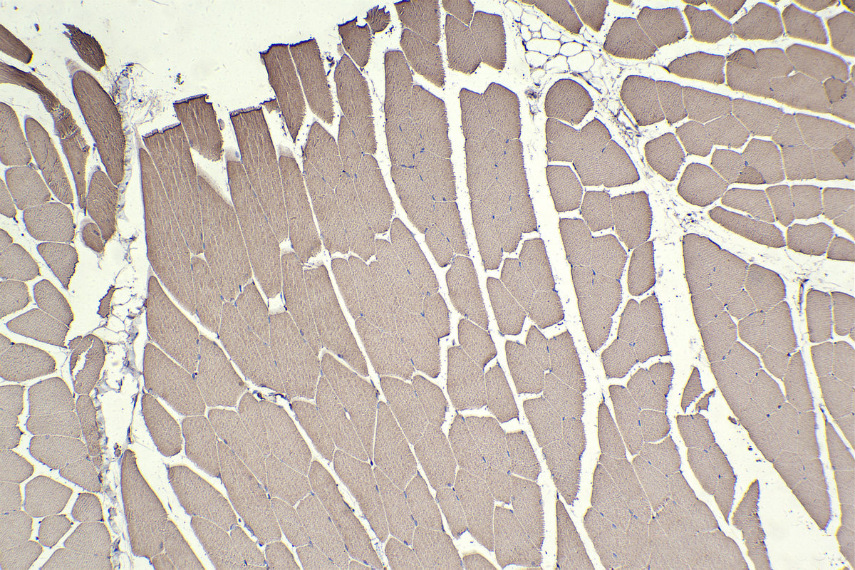 IHC