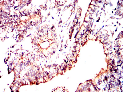 IHC