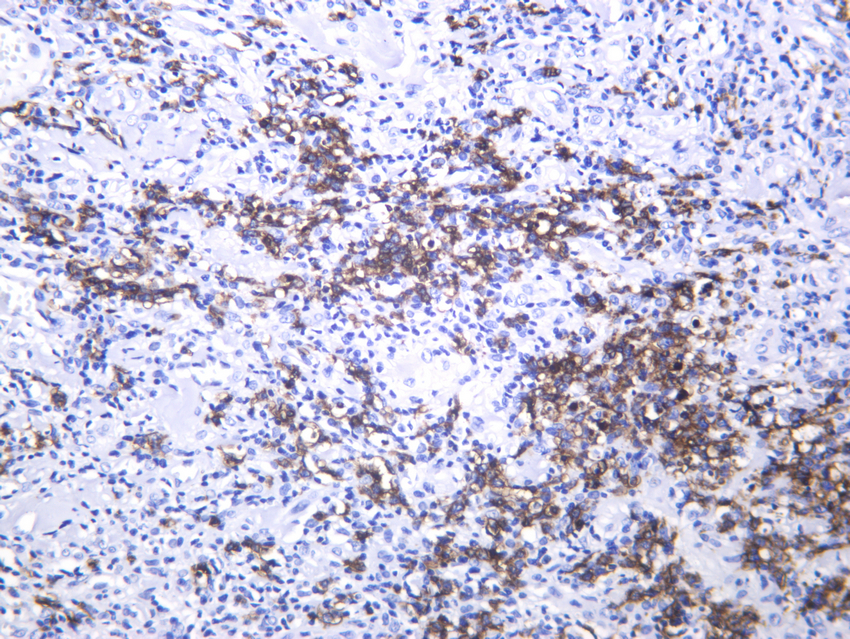 IHC