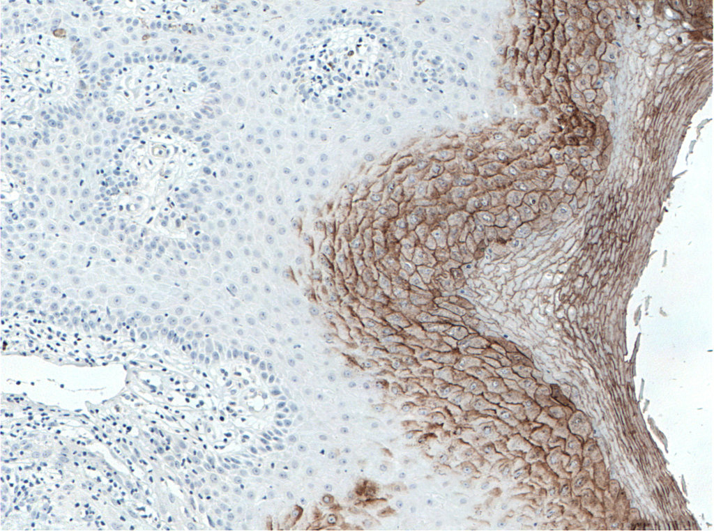 IHC
