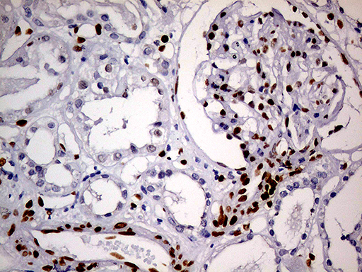 IHC