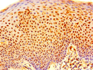 IHC