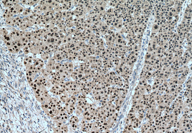 IHC