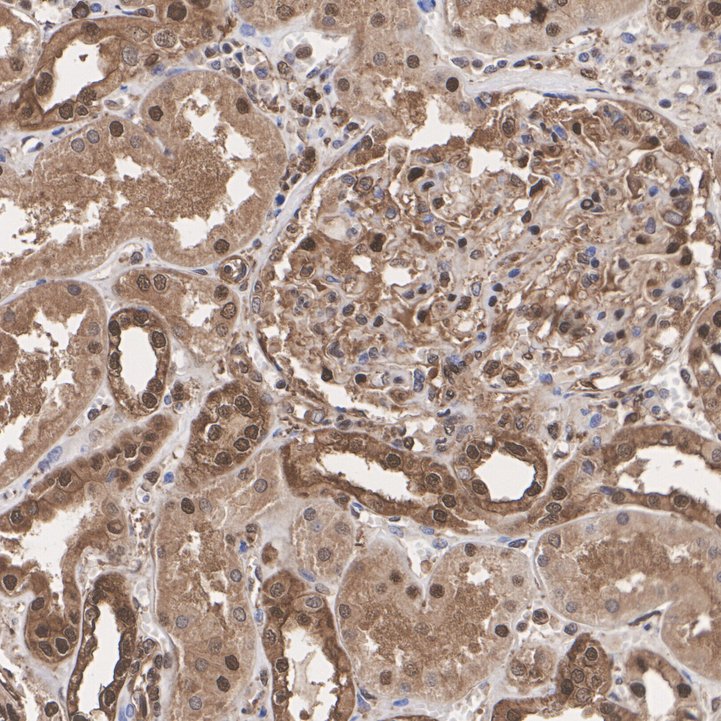 IHC