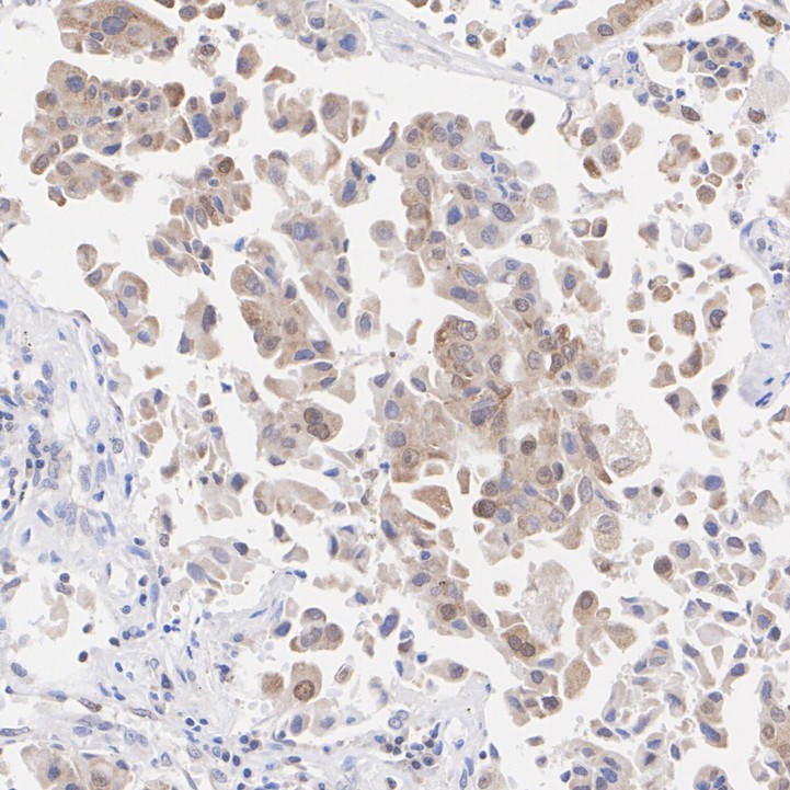 IHC