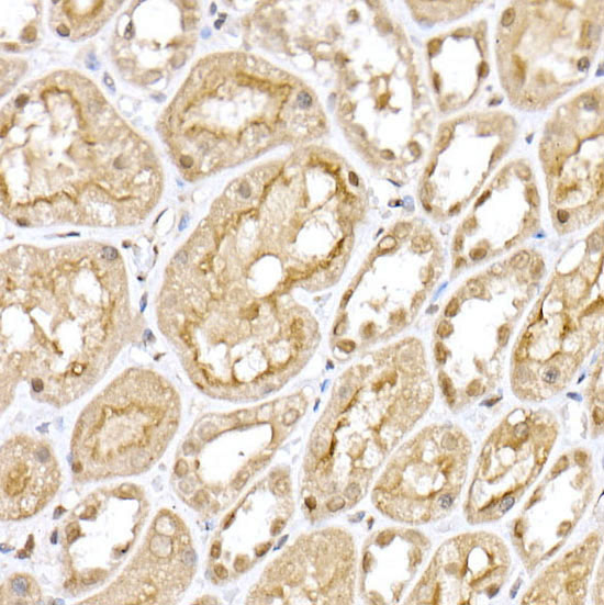 IHC