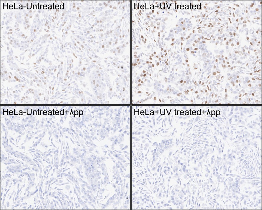 IHC
