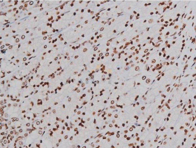 IHC
